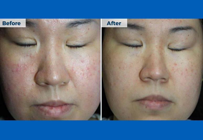 Tasmanian Skin Clinic in Devonport, Tasmania